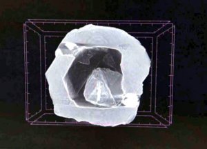 Matrioska diamond x-ray